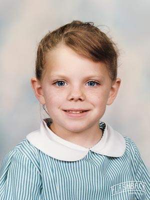 missing-part-photo-after-300px