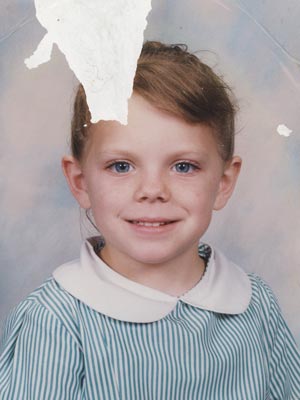 missing-part-photo-before-300px